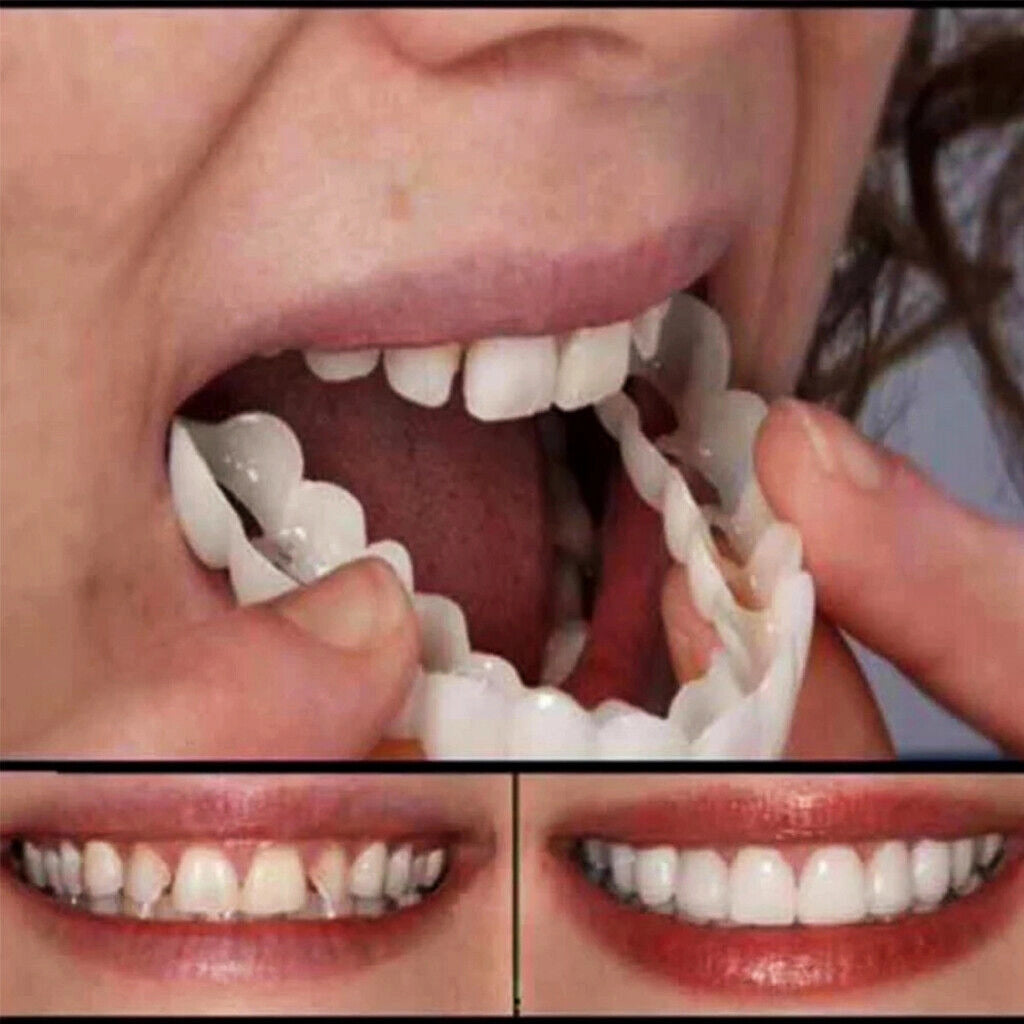 Faccette Dentali Cosmetiche Set 1 Kit Copri Denti Estetici in Plastica Modellabile Temporanei Riutilizzabili per Uso Estetico